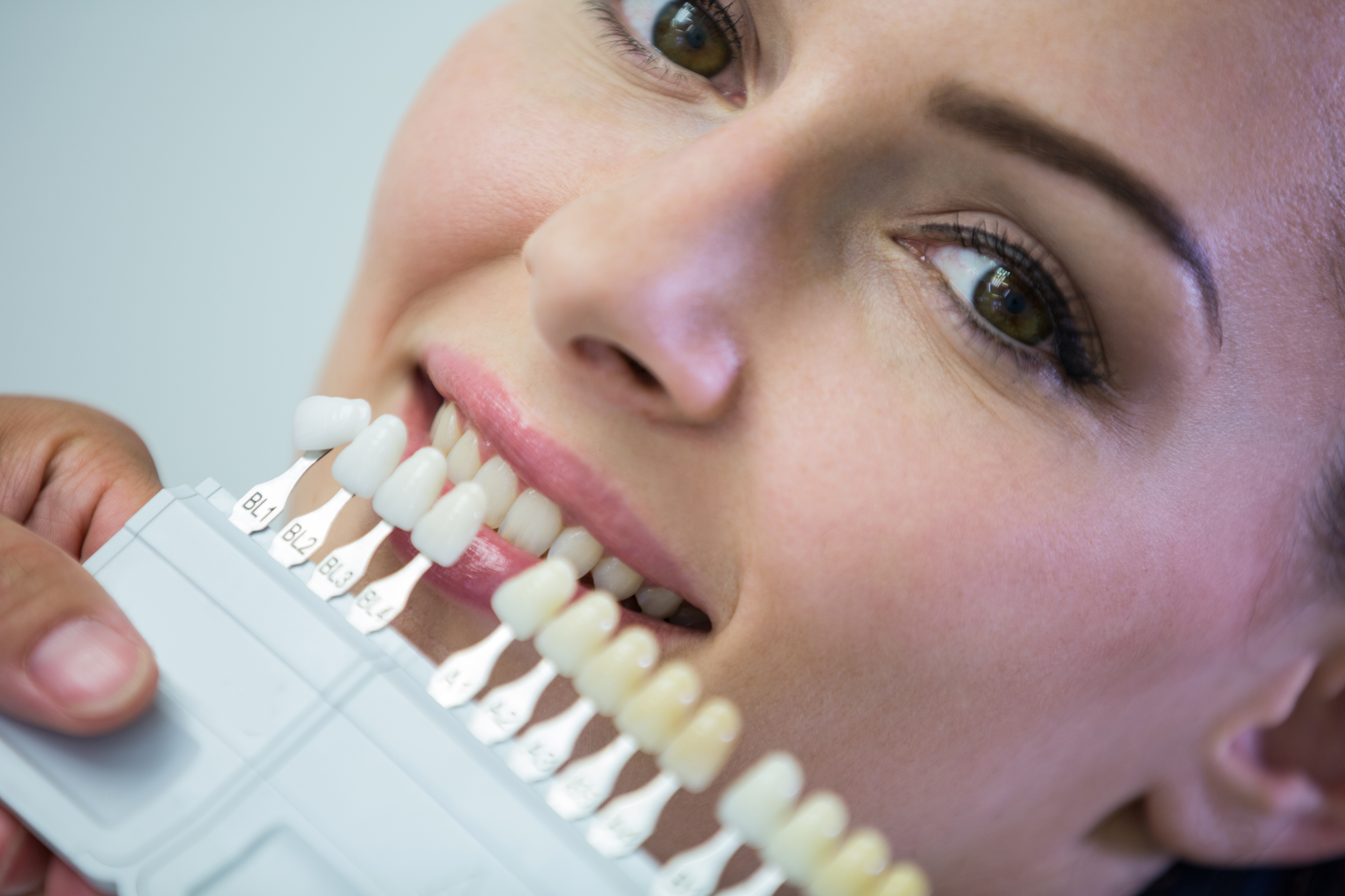 Person smiling showing teeth and comparing it to the color options